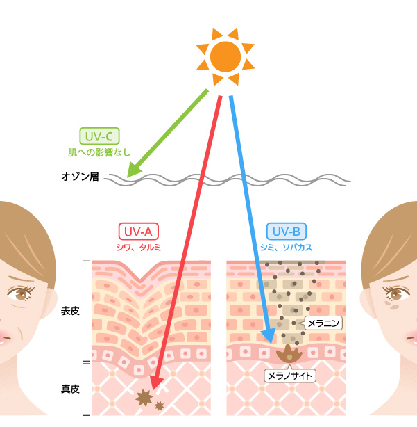 紫外線と肌のダメージ