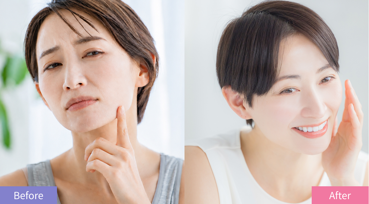 白浮きしない酸化亜鉛 Before / After